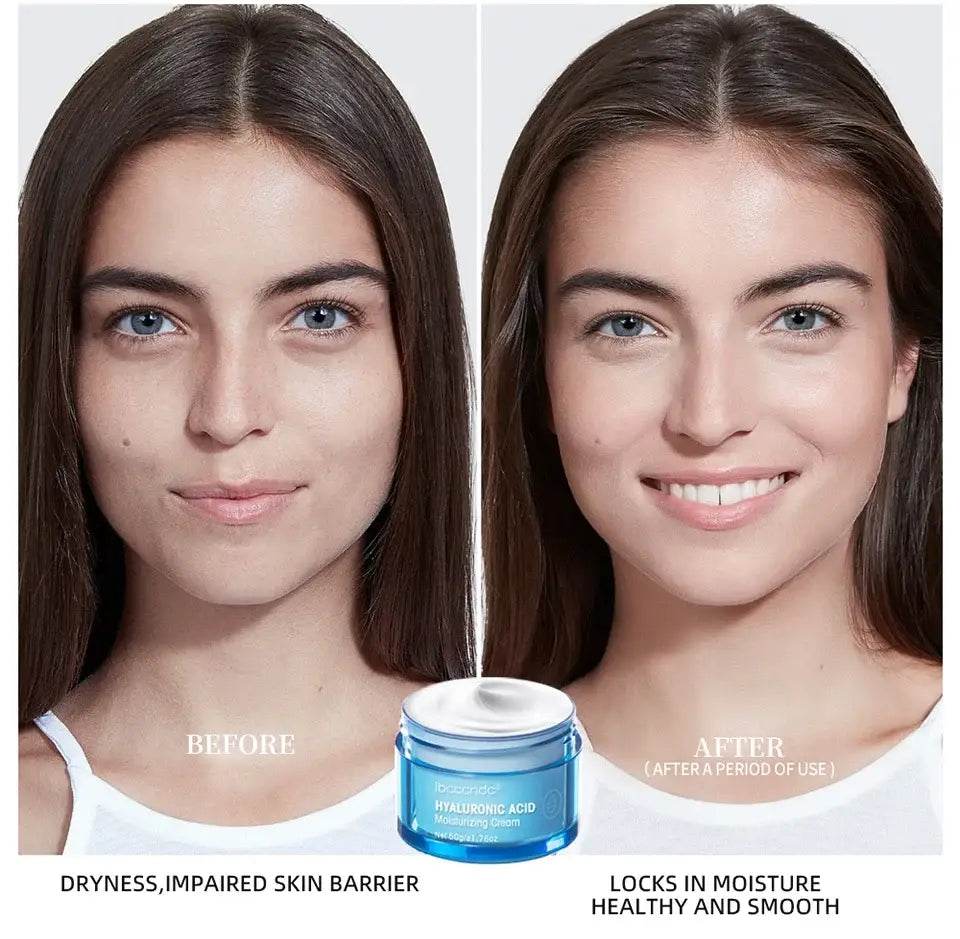 Hyaluronic Acid Moisturizer - Hydrating Water Gel Facial Cream for Dry Skin 50g - BON's