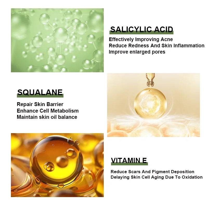 Anti-Acne Face Serum Salicylic Acid Acne Removing Essence Squalane Vitamin E Moisturizing Brightening Korean Skincare Products - BON's