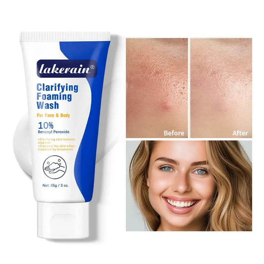 Acne Foaming Wash for Deep Cleaning, Pore Unclogging, and Redness Reduction in Facial & Body Skin Care - BON's
