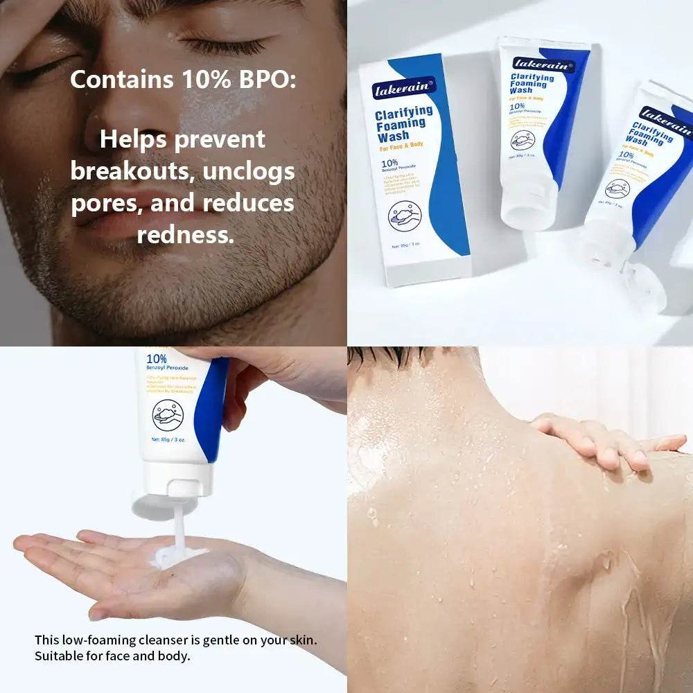 Acne Foaming Wash for Deep Cleaning, Pore Unclogging, and Redness Reduction in Facial & Body Skin Care - BON's
