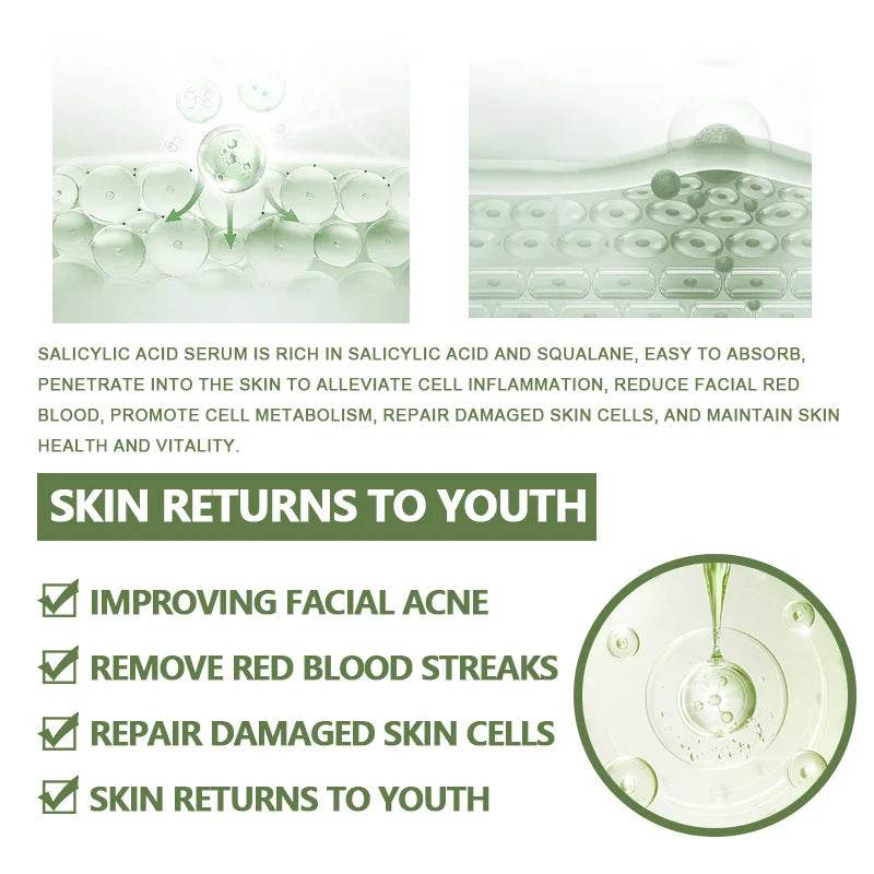 Anti-Acne Face Serum Salicylic Acid Acne Removing Essence Squalane Vitamin E Moisturizing Brightening Korean Skincare Products - BON's