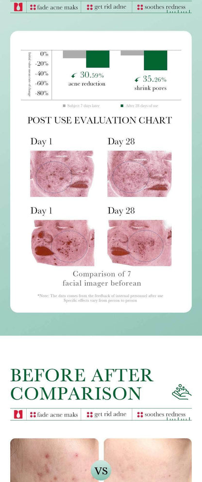 BIOAQUA Salicylic Acid Facial Cleanser Acne Treatment Moisturizing Oil Control skincare Face Wash Foam Face Cleanser Skin Care - BON's