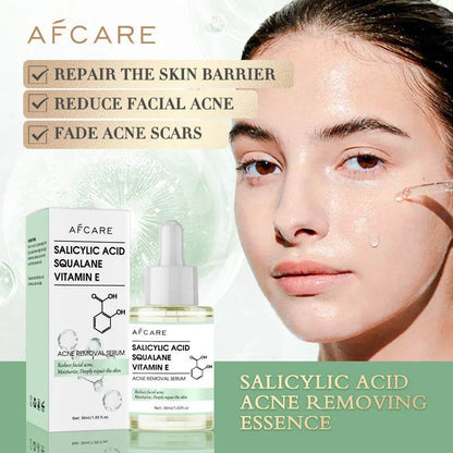 Anti-Acne Face Serum Salicylic Acid Acne Removing Essence Squalane Vitamin E Moisturizing Brightening Korean Skincare Products - BON's