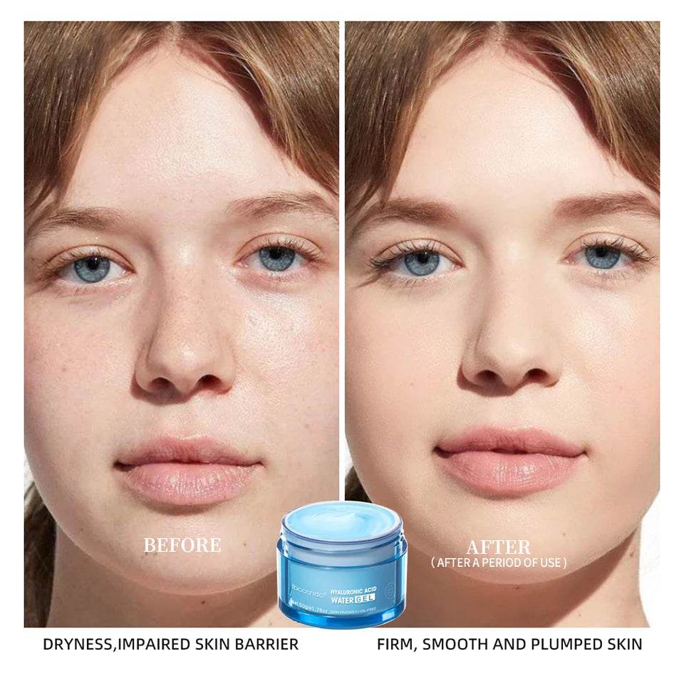 Hyaluronic Acid Moisturizer - Hydrating Water Gel Facial Cream for Dry Skin 50g - BON's