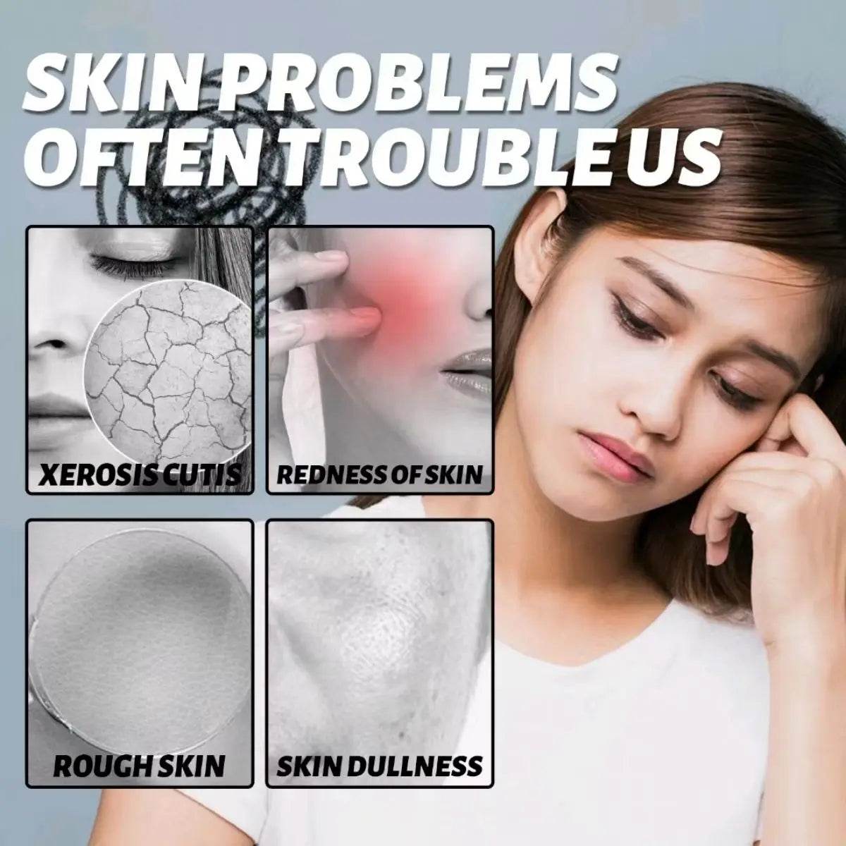 Moisturizing Face Cream, Repair Dry Skin, Protect Skin, Improve Skin Quality, Lubricate And Tighten Skin, Make Skin Delicate And - BON's