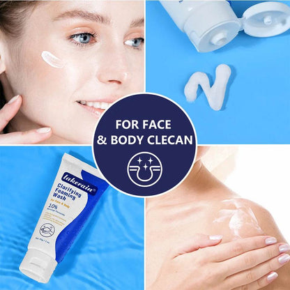 Acne Foaming Wash for Deep Cleaning, Pore Unclogging, and Redness Reduction in Facial & Body Skin Care - BON's