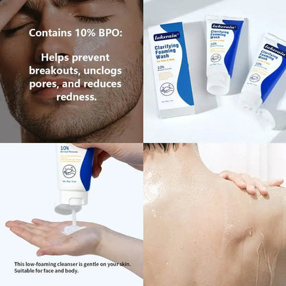 Acne Foaming Wash for Deep Cleaning, Pore Unclogging, and Redness Reduction in Facial & Body Skin Care - BON's